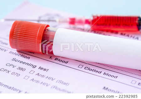 Sample blood collection tube with blank label 22392985