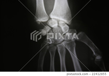 X-ray photos of  patients 22412855