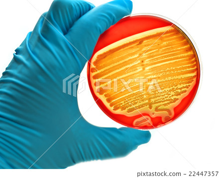 Bacteria culture plate 22447357