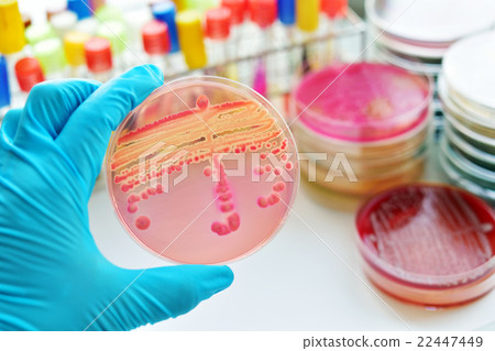 Stock Photo: Bacteria culture plate