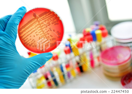 Bacteria culture plate 22447450