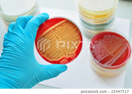 Stock Photo: Bacteria culture plate