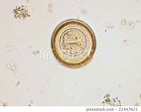 Egg of Hymenolepis diminuta  22447621