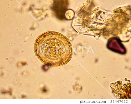 Egg of Hymenolepis diminuta  22447622