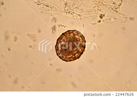 Egg of Ascaris lumbricoides  22447626