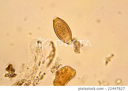 Egg of Trichuris trichiura  22447627