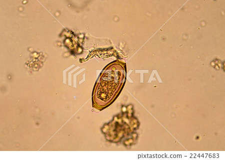 Egg of helminth in stool 22447683