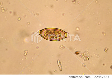 Egg of helminth in stool 22447684