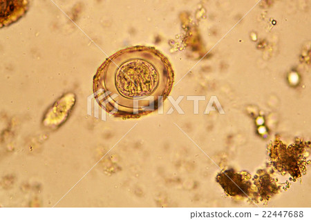 Egg of helminth in stool 22447688