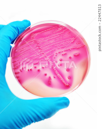 Bacteria colonies Bacteria colonies 22447813