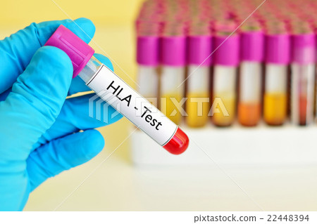 Blood for HLA test Blood for HLA test 22448394