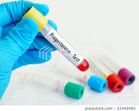 Blood progesterone test Blood progesterone test 22448465