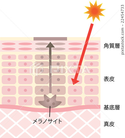 Stained skin structure 22454733