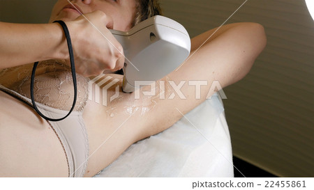 Woman gets laser hair removal treatment underarm Woman gets laser hair removal treatment underarm 22455861