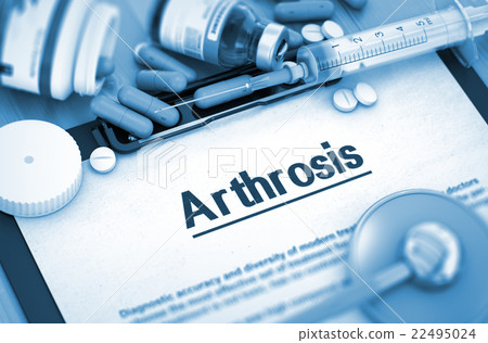 Arthrosis Diagnosis. Medical Concept. Arthrosis Diagnosis. Medical Concept. 22495024
