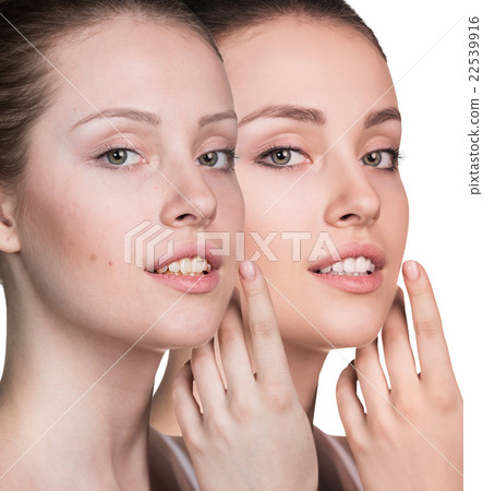 Young woman without and with makeup 22539916
