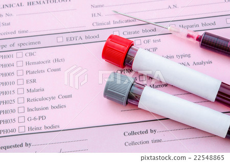 Blood vial with blood sample with syringe. 22548865