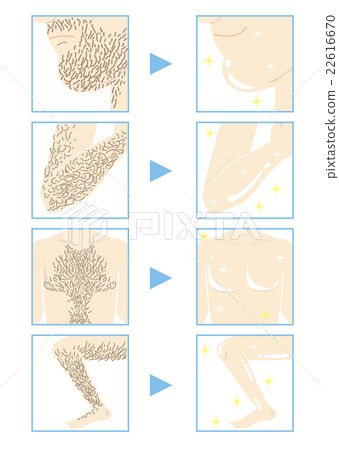 Men's Aesthetic · Hair Removal (Part B Type) 22616670