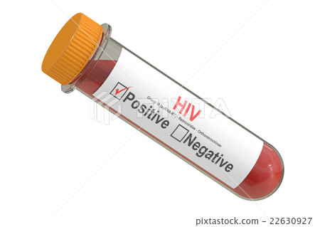 test tube with sample blood positive HIV virus - Stock Illustration ...