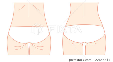 之前的臀部（精緻） 22645515