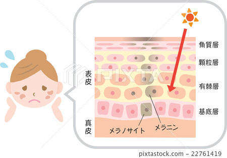 淡斑皮膚女士 22761419