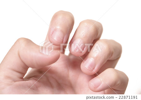 深深的指甲 深深的指甲 22871191