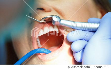 Woman getting a dental treatment 22885988