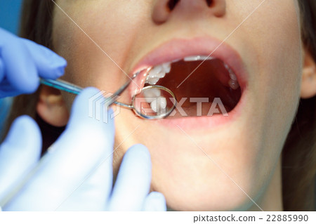 Woman getting a dental treatment 22885990