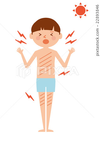 Sunbath inflammation child whole body illustration Sunbath inflammation child whole body illustration 22893846