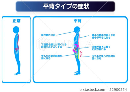 Flat type distortion symptoms 22900254