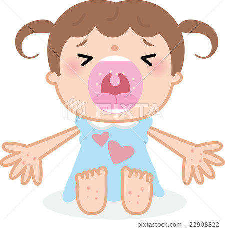 Hand & foot mouth disease girl eruption Hand & foot mouth disease girl eruption 22908822