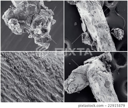 Scientific collage. Photo from electron microscope Scientific collage. Photo from electron microscope 22915879