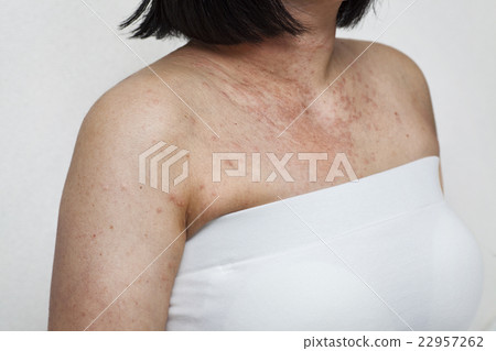 Caterpillar stabbed women 22957262