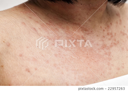 Caterpillar stabbed women 22957263