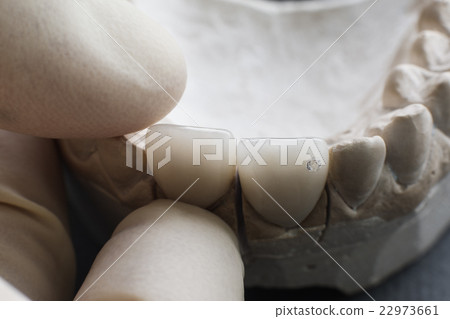 Dentist installs ceramic dentures on plaster jaw 22973661