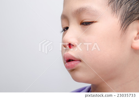 Young Asian boy with bleeding from nose Young Asian boy with bleeding from nose 23035733