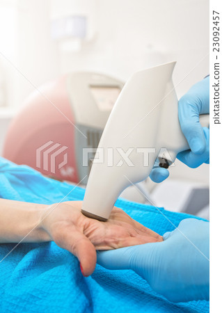 Procedure against hyperhidrosis 23092457