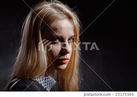 girl with pimply skin girl with pimply skin 23175165