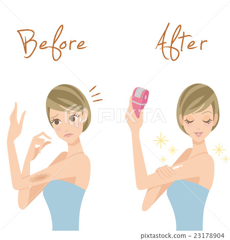 Waste hair treatment 23178904