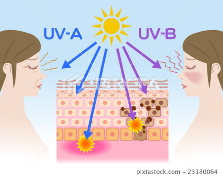 Mechanism of tanning Santan and Sunburn - Stock Illustration [23180064 ...