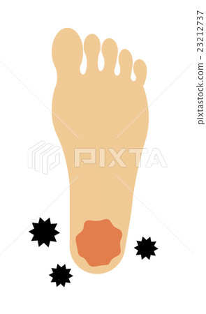 腳跟運動員的腳 腳跟運動員的腳 23212737