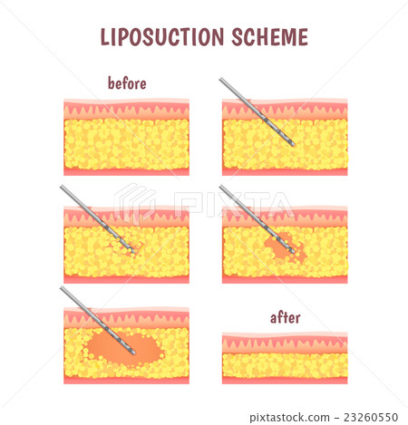 scheme of cosmetic surgery 23260550