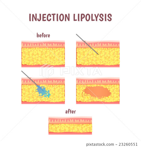 scheme of cosmetic surgery 23260551