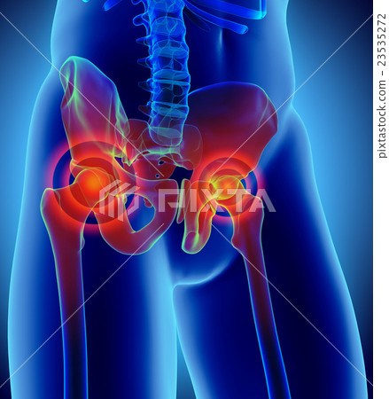 Hip painful skeleton x-ray, 3D illustration. 23535272