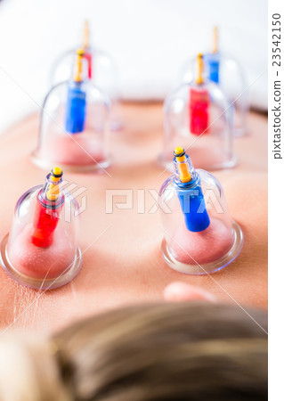 Alternative practitioner cupping woman Alternative practitioner cupping woman 23542150