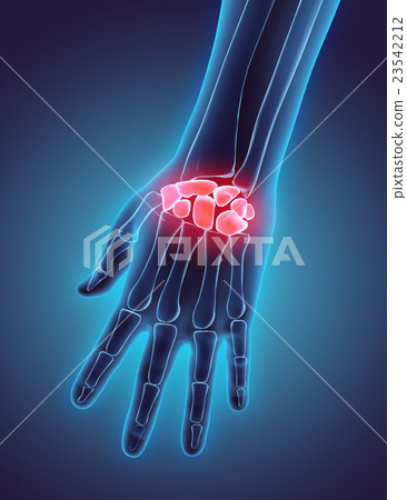 3D illustration of Carpal, medical concept. 3D illustration of Carpal, medical concept. 23542212