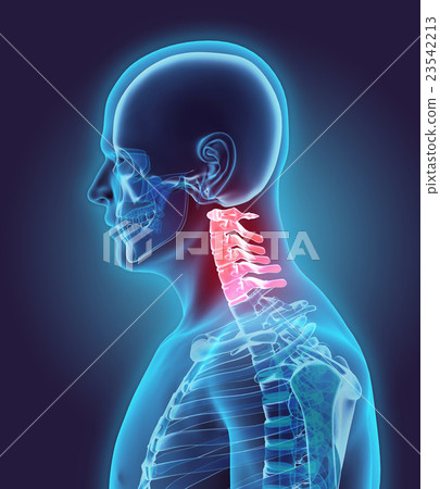 3D illustration of Cervical Spine, medical concept 23542213