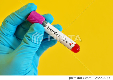 Blood sample positive with Borrelia test Blood sample positive with Borrelia test 23550243