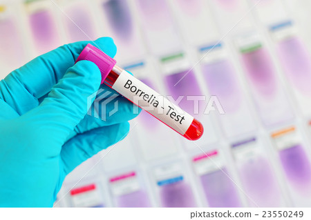 Blood sample for Borrelia test Blood sample for Borrelia test 23550249