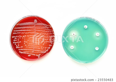 Bacteria culture and susceptibility test 23550483